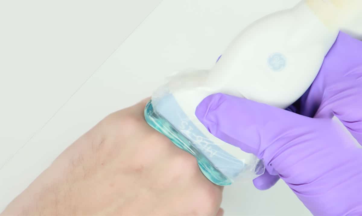 aiSon Technologies' first adaptive ultrasound pad. (Credit: aiSon Technologies)