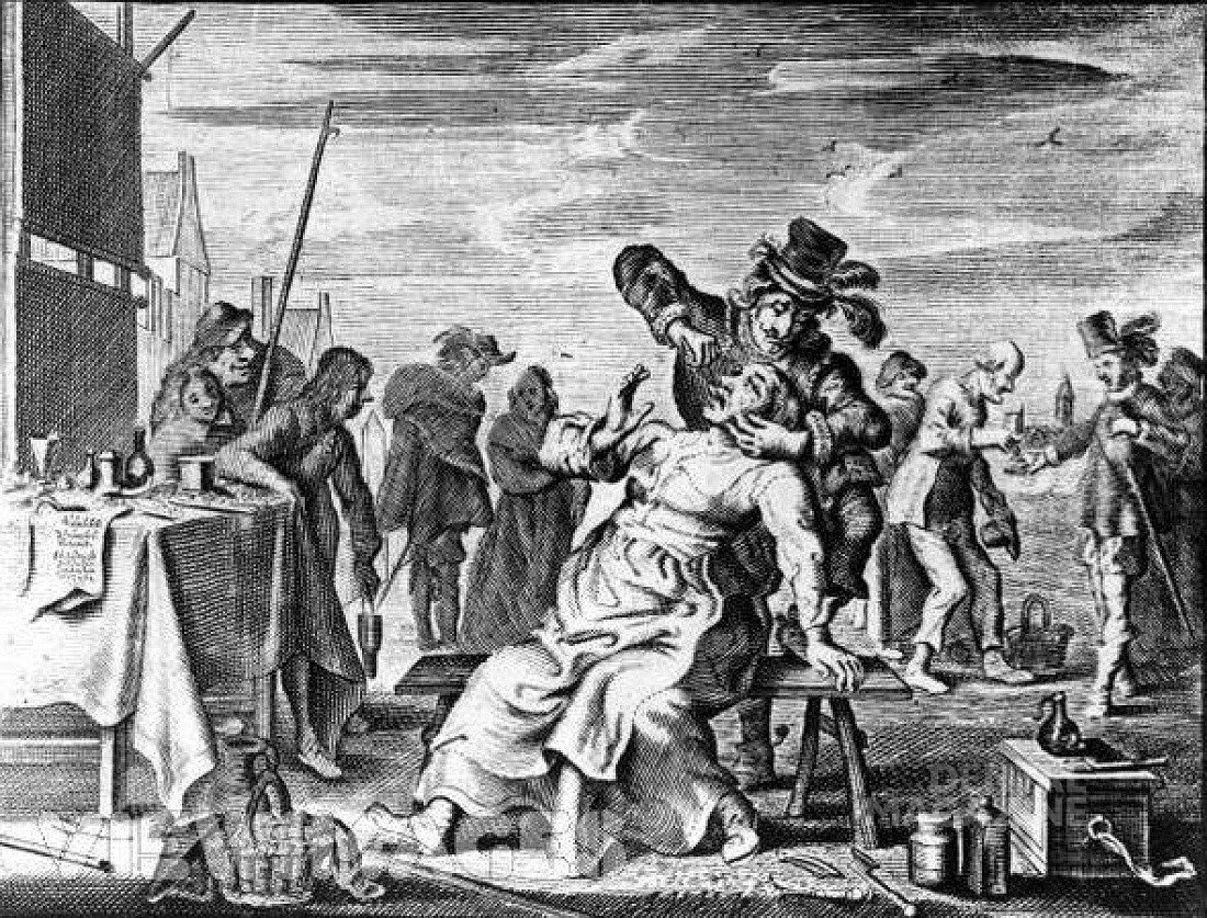 A History of Dental Extractors