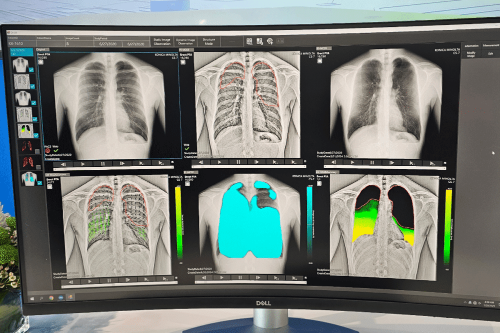 featured-2-4-1000x667-1