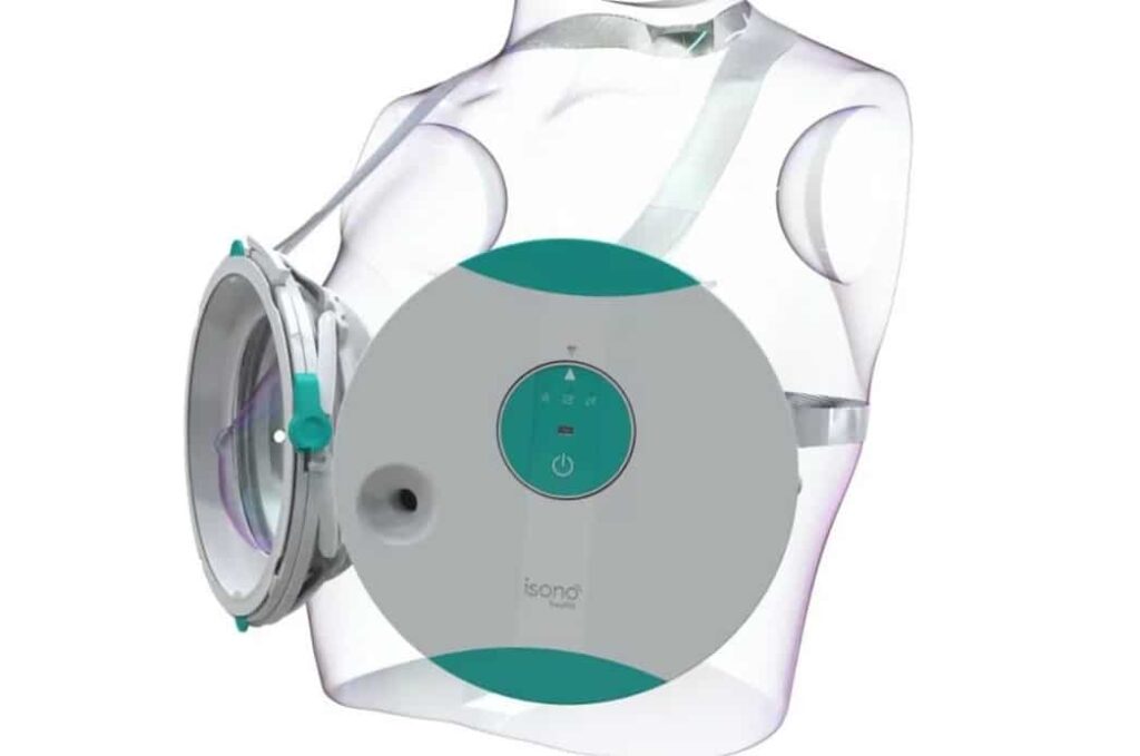 AI-Driven Portable and Automated Breast Ultrasound Scanner