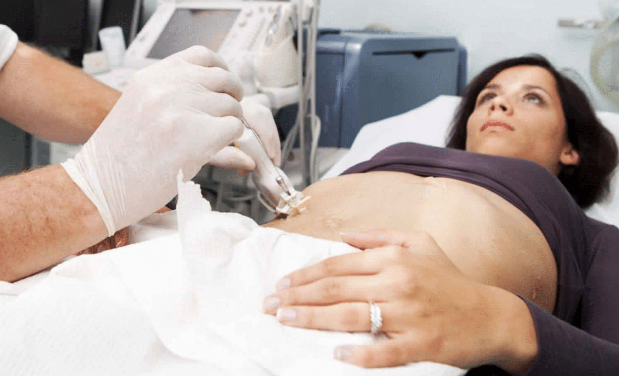 liver-biopsy-jpg-1250x759-1 Liver biopsy. (Credit: Health Jade)