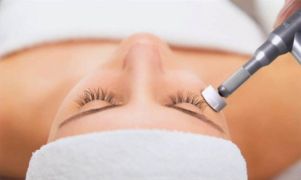 Facial Rejuvenation: Micro-Channeling Great Skin