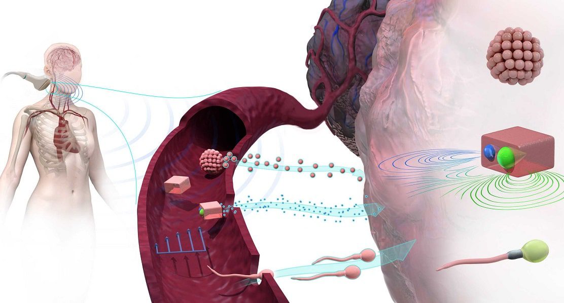 nanorobots-ethzurich "There is a lot of work going on at the moment where people are using a magnetic field to drag a microrobot, but in in our case we use the acoustic field." (Credit: ETH Zürich)