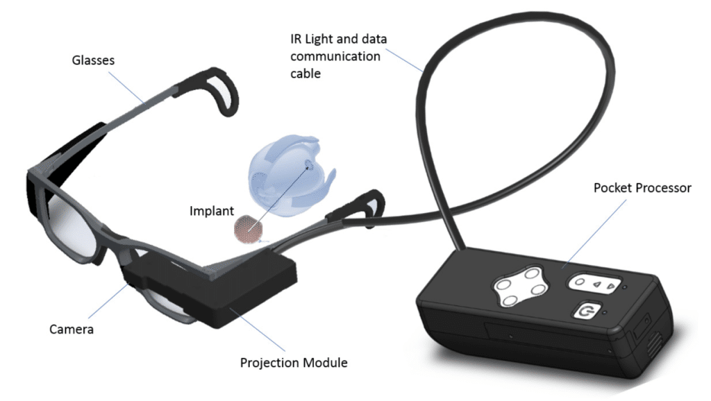 The Prima device description (Credit: Pixium Vision)