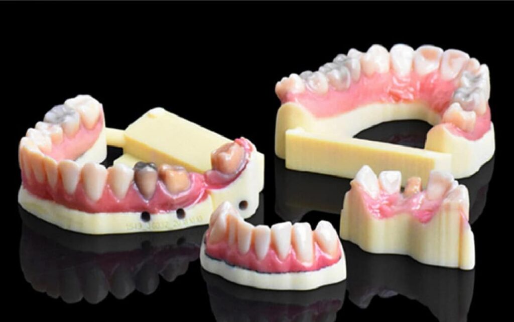 IDS. Stratasys’ New 3D Dental Printer