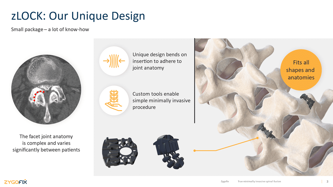 zlock (Credit: ZygoFix)