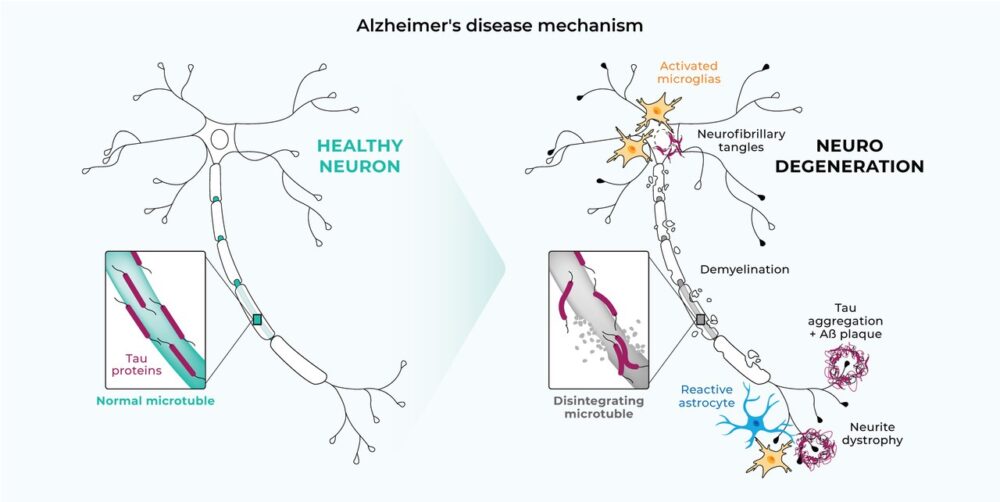 5-schemas-v02_page_41-1000x502-1 Courtesy of BrainTale