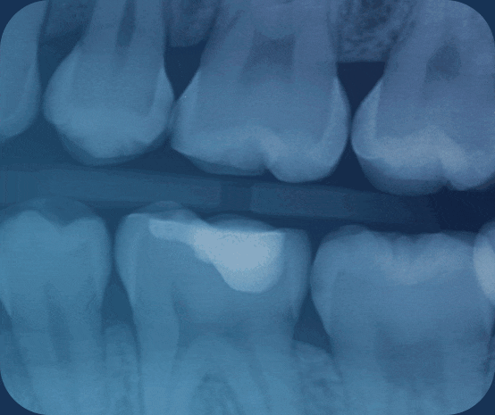 6497cc38-pearl-system1