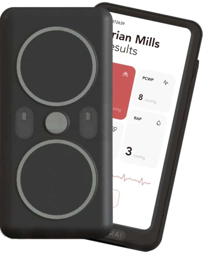 SAVE Sensor System to enable cardiac insights. Acorai Device.