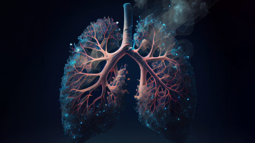 ai_lung_cancer_adobestock Today, if we take lung cancer for example, which is the most aggressive of all cancers, we observe a mortality rate of 94% at 5 years if the disease is diagnosed at an advanced stage. And a survival rate of 92% at 15 years if it is diagnosed at an early stage. (Credit: AdobeStock)