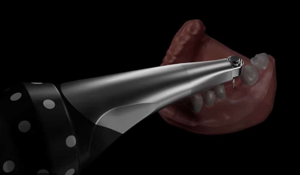 IDS Dental Trends: Handheld Robotic Drill, 3D Printing, Bone Regeneration, and More