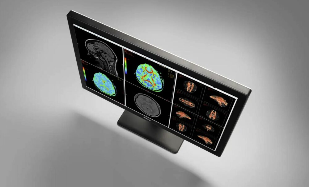 remote radiology with Barco equipment