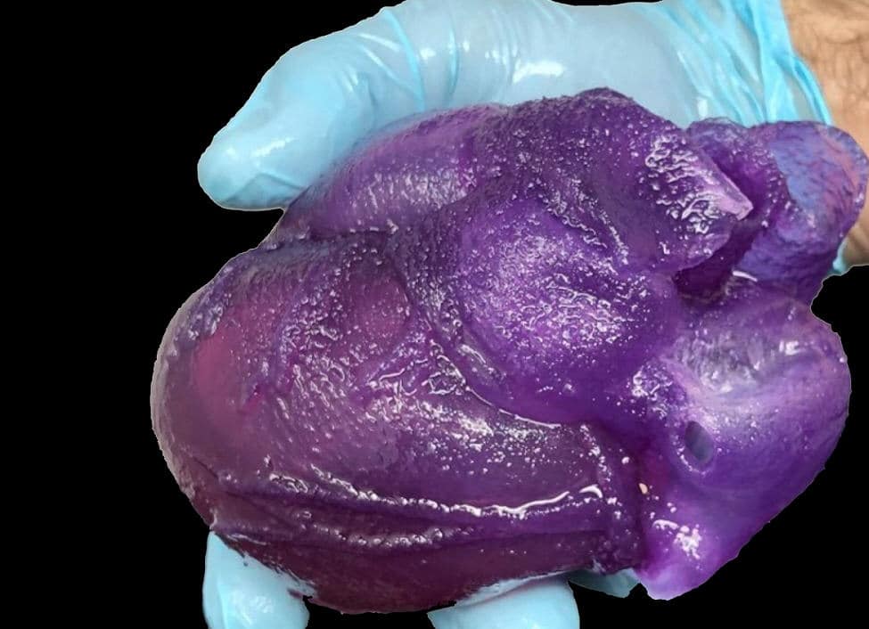 3D Bioprinting: Highly Realistic Models of Human Hearts
