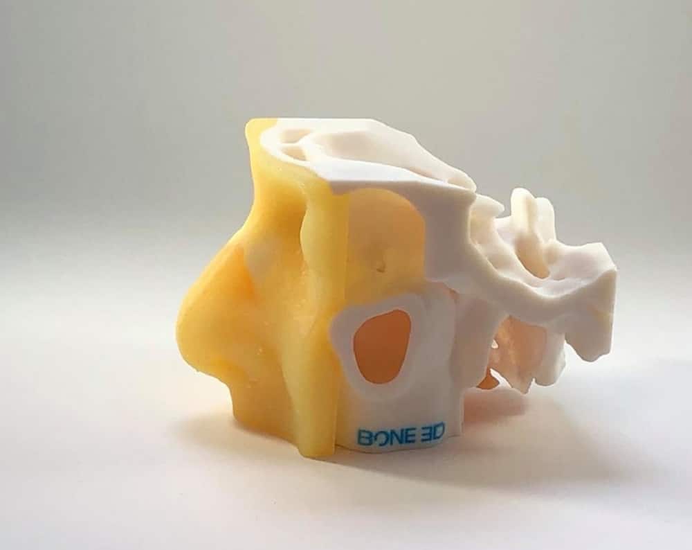 Covid-19: 3D Printed Nasopharyngeal Swab Simulators for Training