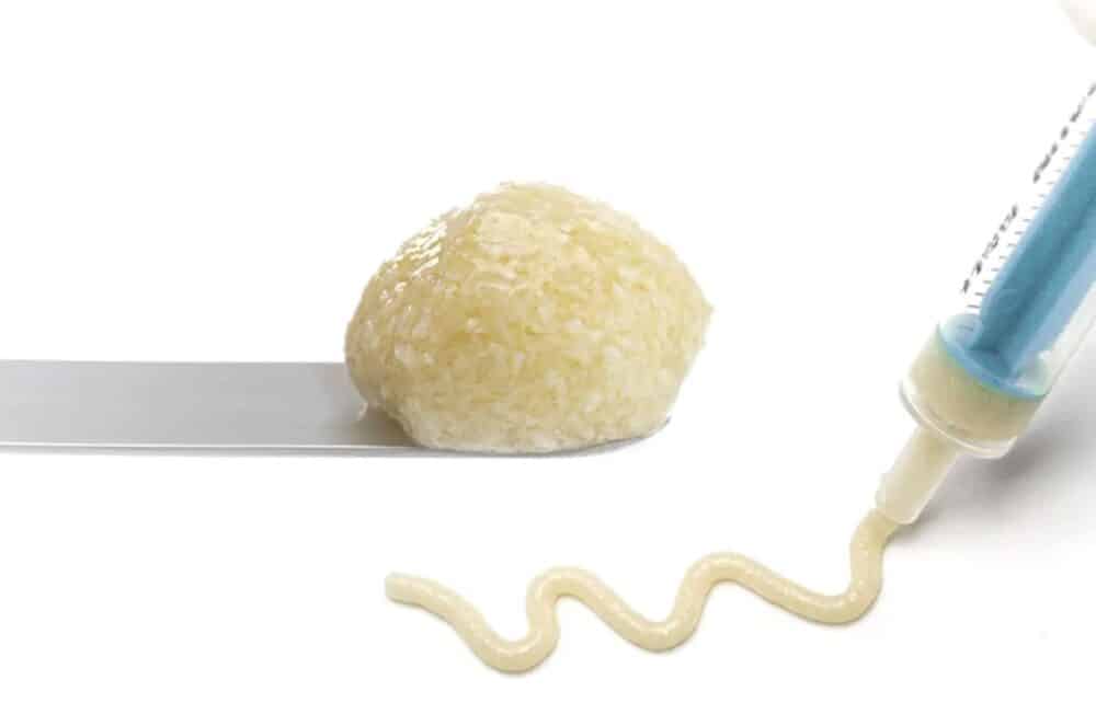 botiss-maxgrafthya-1000x663-1 maxgraft +HyA. Courtesy of Botiss.