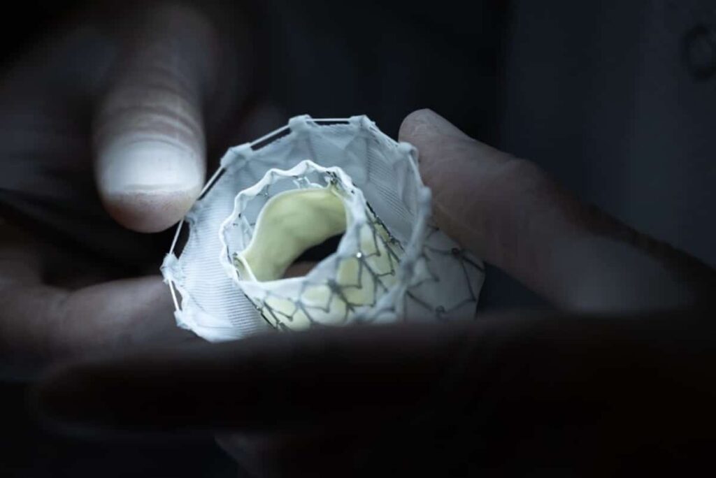 Less Invasive Surgery: Five Cutting-Edge Innovations