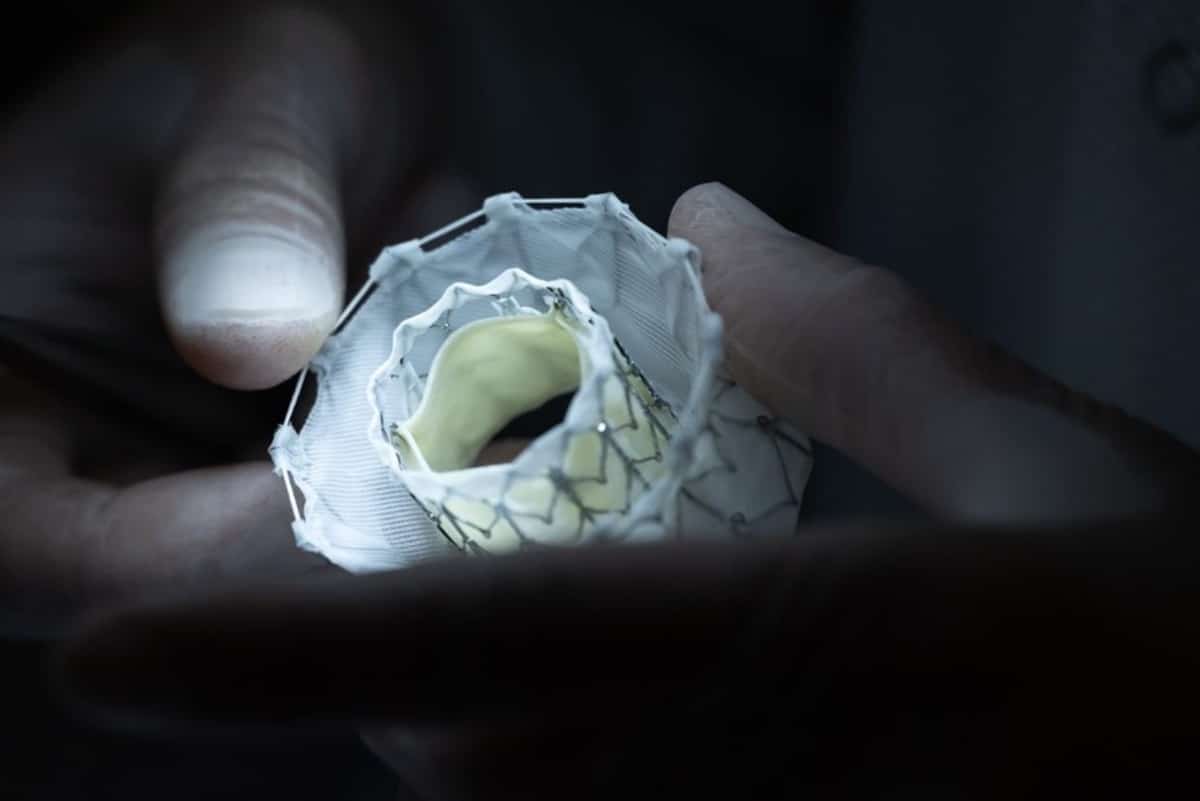 Less Invasive Surgery: Five Cutting-Edge Innovations