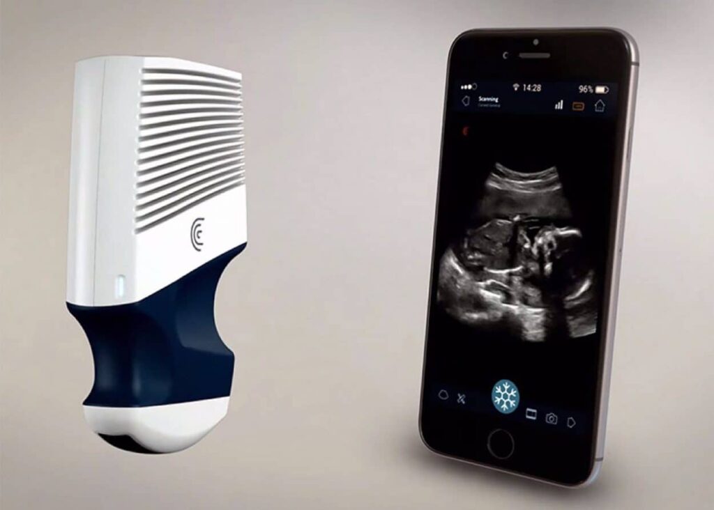 Meet Clarius, Pocket-Sized Wireless Scanner