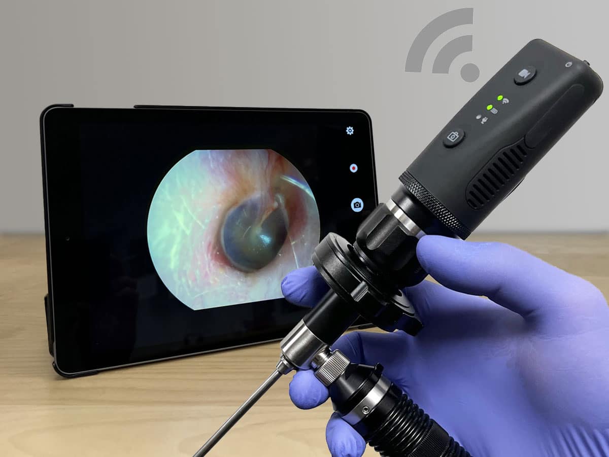 The DE1270 Mobile Wireless Endoscopy Camera. (Credit: Firefly)