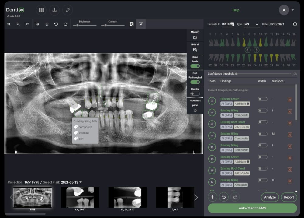 dent-ai-1000x716-1 dentistry
