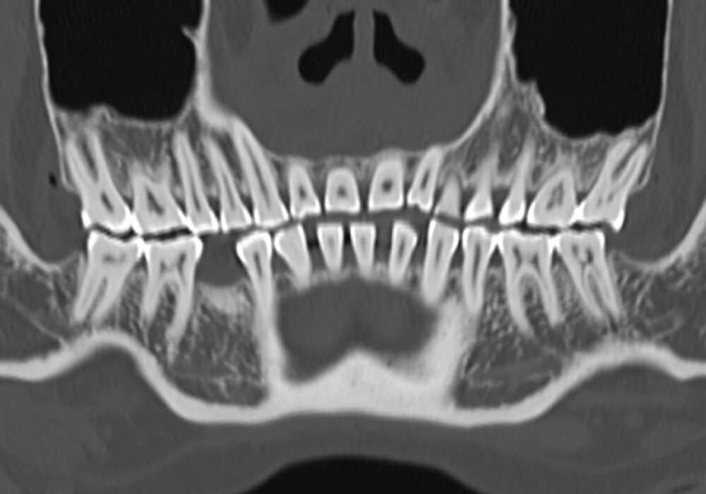 For dental applications, the system provides panoramic and cross-sectional views, auxiliary reference information for orthodontic treatment plans. Courtesy of United Imaging.