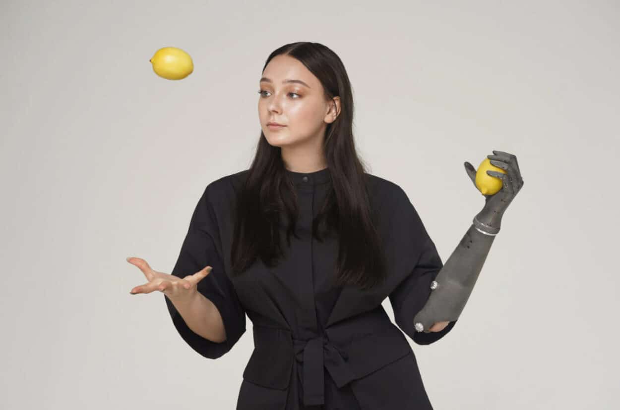 Esper Bionics’ goal was to create a prosthetic arm "inspired by the beauty of the human body and the lightness and durability of aviation technology." (Credit: Esper Bionics)