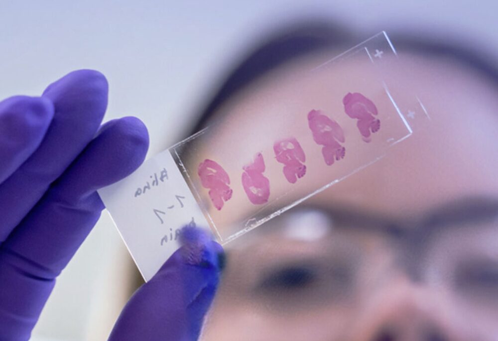 evotec-drug_discovery_services-min-1000x685-1 Courtesy of Evotec