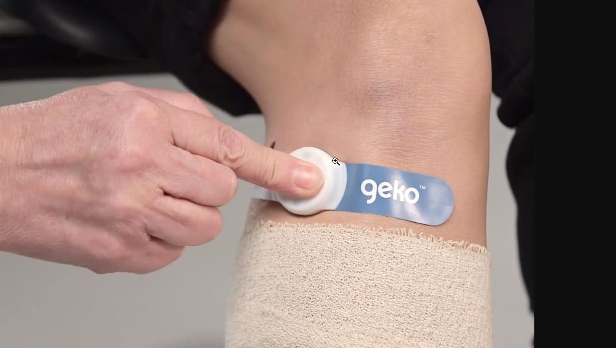 geko-device The software of the geko™ device is controlled with plus and minus buttons, offering 11 different stimulation settings, promoting painless 1Hz frequency contractions. (Credit: Sky Medical Technology)