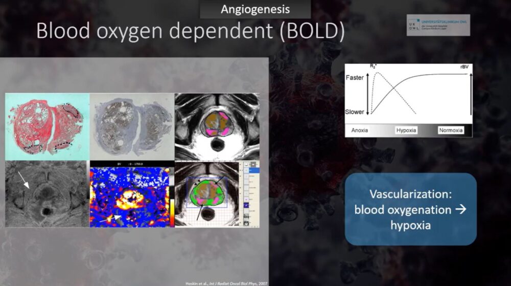 imaging-answers-to-immunotherapy-demands-esr-connect-10-1000x559-1 Screenshot of presentation during the event. Courtesy of the panelist and ECR.