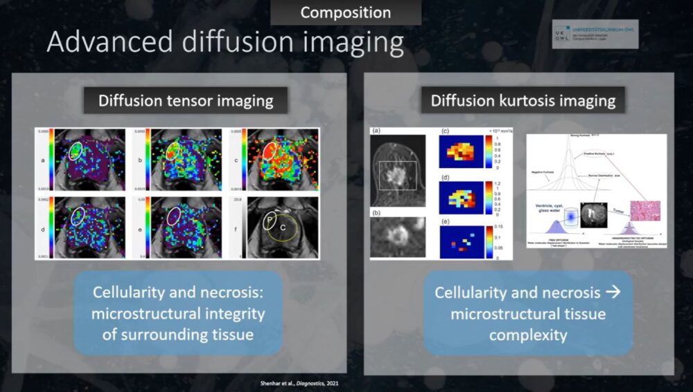 imaging-answers-to-immunotherapy-demands-esr-connect-12-1000x567-1 Screenshot of presentation during the event. Courtesy of the panelist and ECR.