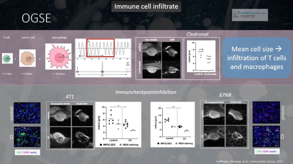 imaging-answers-to-immunotherapy-demands-esr-connect-13-1000x559-1 Screenshot of presentation during the event. Courtesy of the panelist and ECR.
