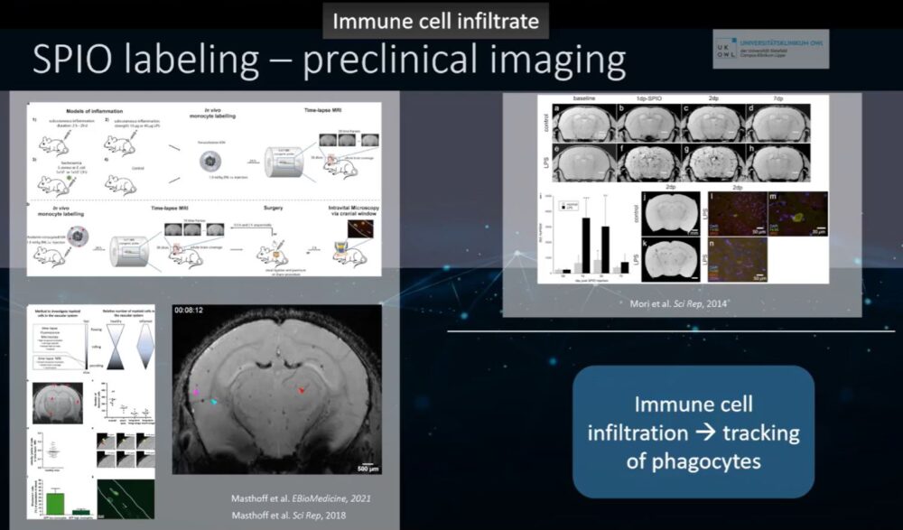 imaging-answers-to-immunotherapy-demands-esr-connect-14-1000x587-1 Screenshot of presentation during the event. Courtesy of the panelist and ECR.