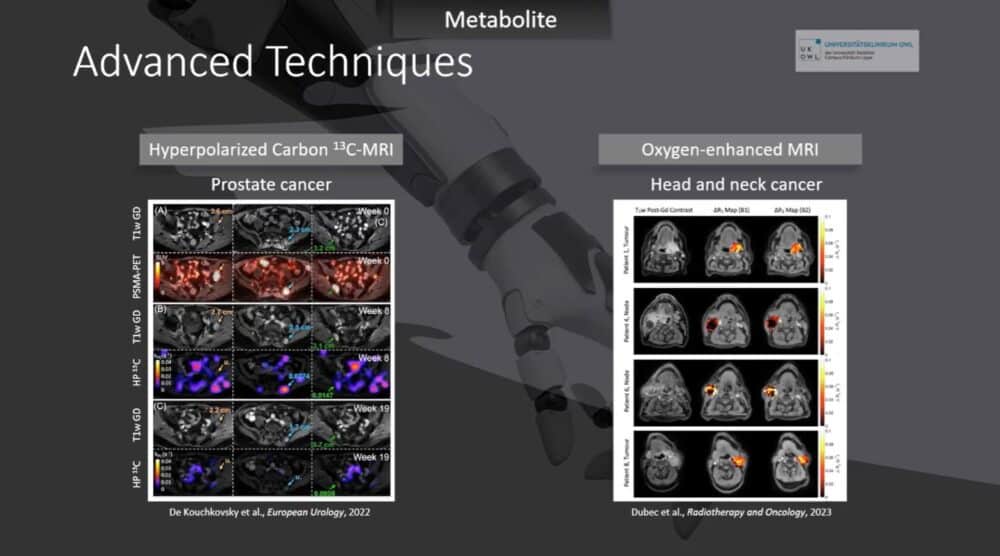 imaging-answers-to-immunotherapy-demands-esr-connect-16-1000x556-1 Screenshot of presentation during the event. Courtesy of the panelist and ECR.