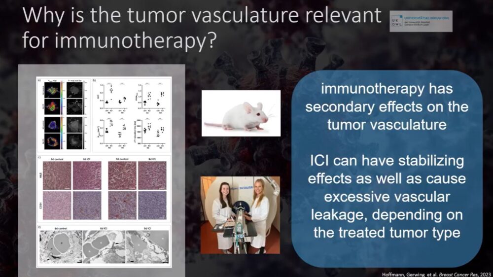 imaging-answers-to-immunotherapy-demands-esr-connect-7-1000x562-1 Screenshot of presentation during the event. Courtesy of the panelist and ECR.