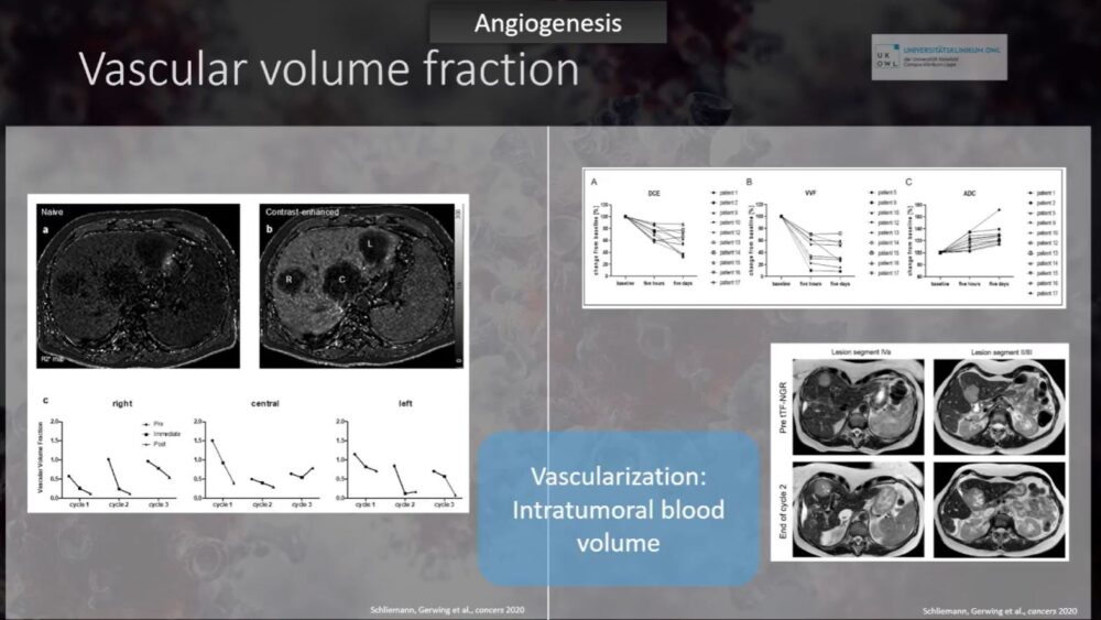 imaging-answers-to-immunotherapy-demands-esr-connect-9-1000x563-1 Screenshot of presentation during the event. Courtesy of the panelist and ECR.