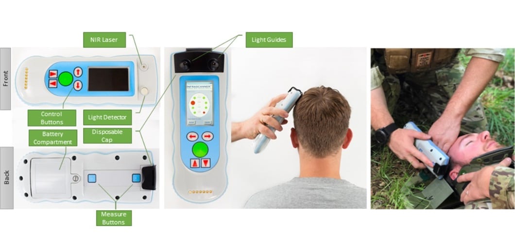 The Infrascanner Model 2000 has been ruggedized for use in remote locations and on the battlefield. (Credit: InfraScan)