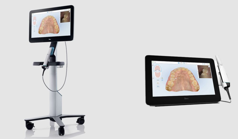 itero-scanner-body-and-tablet-align-technology-1000x586-1 iTero