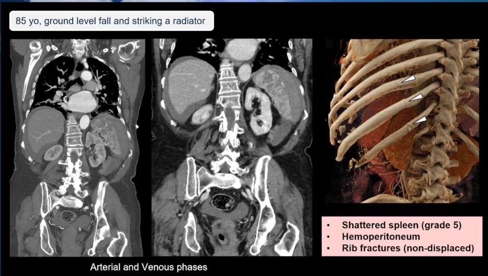 low-to-high-impact_-principles-in-whole-body-imaging-esr-connect-1-1000x566-1