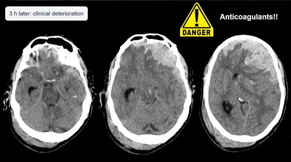 low-to-high-impact_-principles-in-whole-body-imaging-esr-connect-10-1000x558-1 Screenshot of presentation. Courtesy of the panelist and ECR.