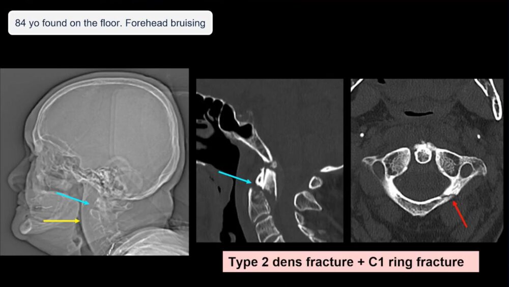 low-to-high-impact_-principles-in-whole-body-imaging-esr-connect-11-1000x565-1