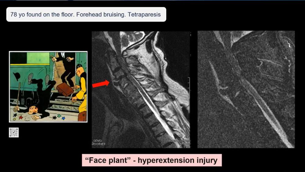 low-to-high-impact_-principles-in-whole-body-imaging-esr-connect-14-1000x565-1 Screenshot of presentation. Courtesy of the panelist and ECR.