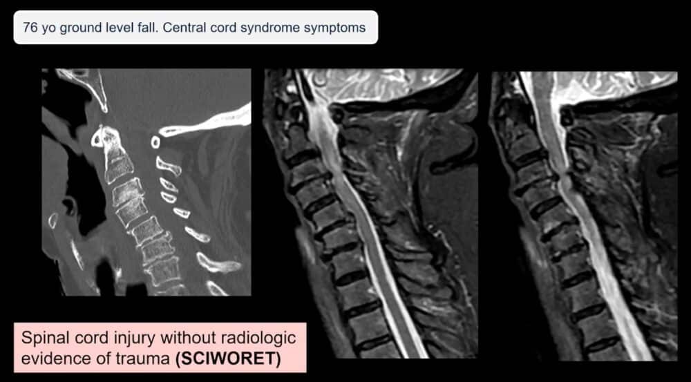 low-to-high-impact_-principles-in-whole-body-imaging-esr-connect-15-1-1000x553-1