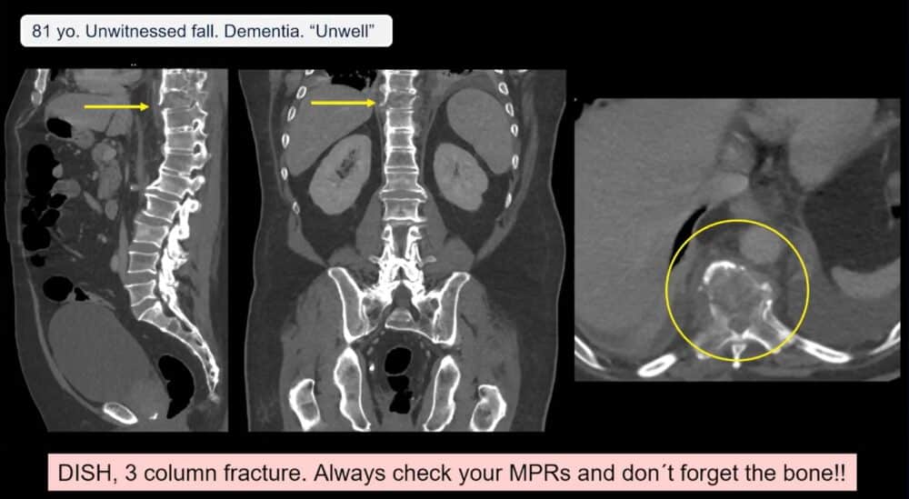 low-to-high-impact_-principles-in-whole-body-imaging-esr-connect-17-1000x549-1