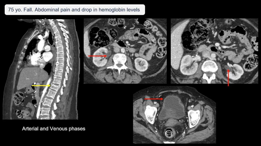 low-to-high-impact_-principles-in-whole-body-imaging-esr-connect-18-1000x561-1