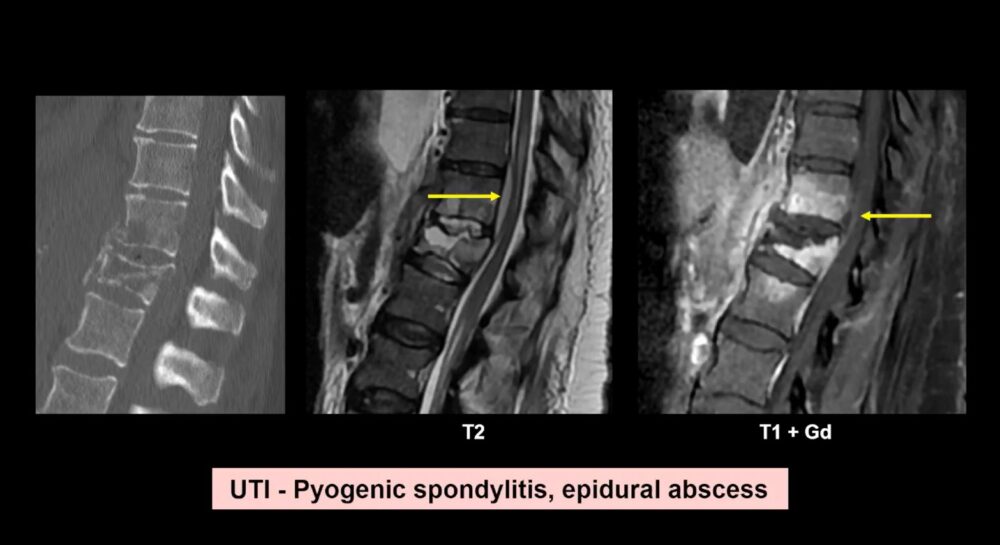 low-to-high-impact_-principles-in-whole-body-imaging-esr-connect-19-1-1000x545-1