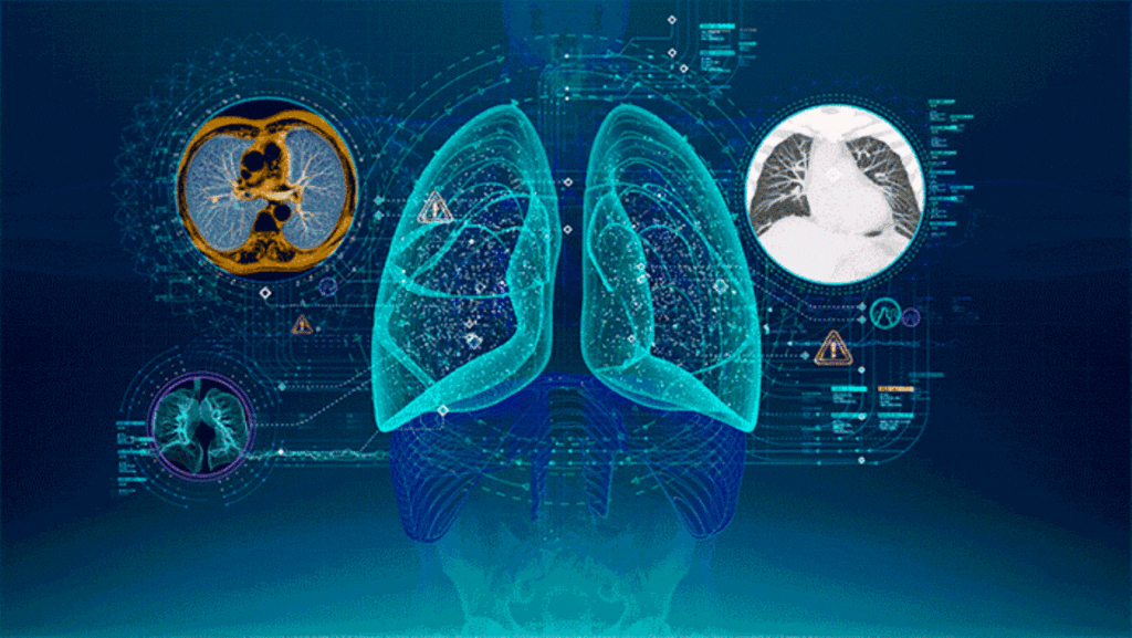 Advances and Challenges in Medical Imaging