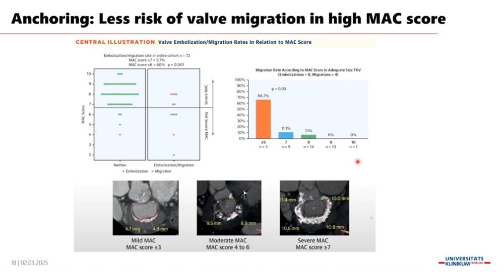 measuring-the-heart_-a-radiologist-with-a-ruler-esr-connect-18-1000x541-1 Screenshot of the presentation. Courtesy of the speaker and ECR.
