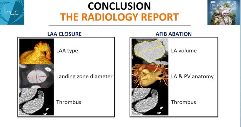measuring-the-heart_-a-radiologist-with-a-ruler-esr-connect-33-1000x528-1 Screenshot of the presentation. Courtesy of the speaker and ECR.
