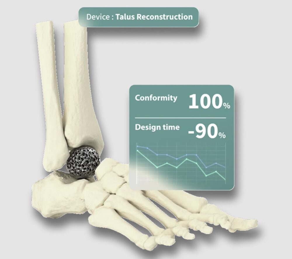 osseolab_design-time-1000x887-1 Advanced biomaterials: OsseoLabs leverages cutting-edge 3D-printing to create tailor-made implants and medical devices with unrivaled accuracy.
