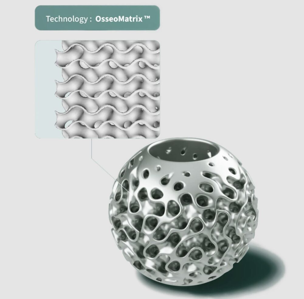 osseolab_osseomatrix-1000x986-1 OsseoMatrix™ is OsseoLab's patented porous architecture, meticulously crafted to mirror natural bone while accommodating each patient’s anatomy.